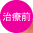 治療前
